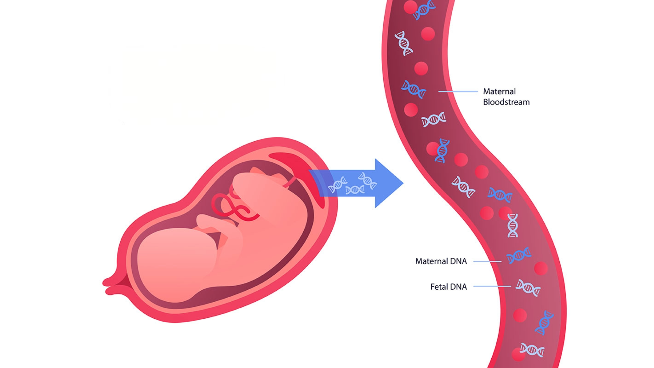 Non-Invasive Prenatal Testing (NIPT): A Breakthrough in Prenatal Care